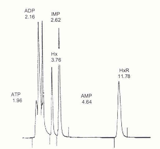 Figura 1. Cromatograma de una mezcla de estándares de ATP y sus catabolitos (ADP, IMP, Hx, AMP, HxR). 