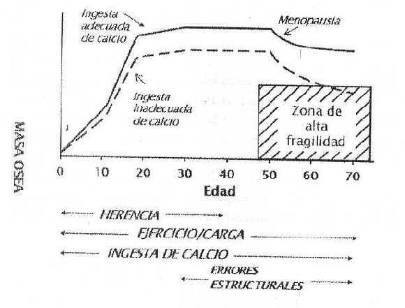 Figura 1. Factores que afectan la masa ósea en el tiempo. Cortesía de Robert P. Heaney, M.D. (John A. Creighton University Professor, Creighton University).